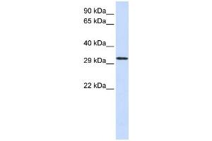 Western Blotting (WB) image for anti-Chromosome 21 Open Reading Frame 2 (C21orf2) antibody (ABIN2458962) (C21orf2 Antikörper)