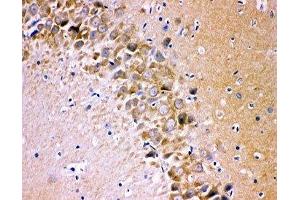 IHC-P testing of rat brain tissue (Glutamate Receptor 1 Antikörper  (AA 19-360))