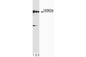 Western blot analysis of Sur-2. (MED23 Antikörper)