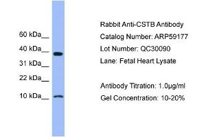 WB Suggested Anti-CSTB  Antibody Titration: 0. (CSTB Antikörper  (N-Term))