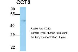 Host: Rabbit  Target Name: CCT2  Sample Tissue: Human Fetal Lung  Antibody Dilution: 1.