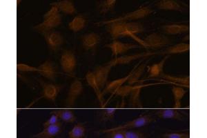 Immunofluorescence analysis of C6 cells using TIMP2 Polyclonal Antibody at dilution of 1:100. (TIMP2 Antikörper)