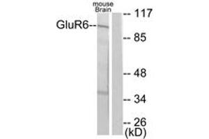 Western blot analysis of extracts from mouse brain cells, using mGluR6 Antibody. (Metabotropic Glutamate Receptor 6 Antikörper  (AA 828-877))