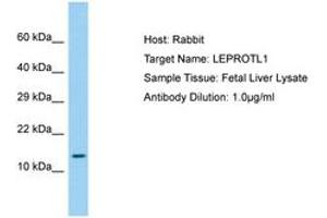Image no. 1 for anti-Leptin Receptor Overlapping Transcript-Like 1 (LEPROTL1) (AA 37-86) antibody (ABIN6750210) (LEPROTL1 Antikörper  (AA 37-86))