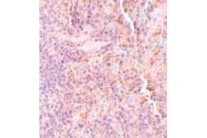 Immunohistochemical staining of rat spleen tissue with 5 ug/mL SQSTM1 polyclonal antibody . (SQSTM1 Antikörper  (C-Term))