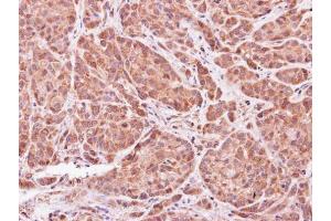 IHC-P Image Immunohistochemical analysis of paraffin-embedded A549 xenograft, using ASB9, antibody at 1:500 dilution.