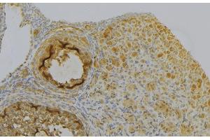 ABIN6277028 at 1/100 staining Human gastric tissue by IHC-P. (Peroxiredoxin 6 Antikörper  (Internal Region))