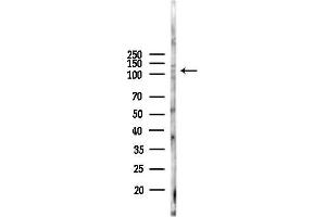 Western blot analysis of lysates from F10-LUC cells(heat-shock,45 min treatment), using Phospho-Semaphorin 4B (Ser825) Antibody at 1/1000 dilution.