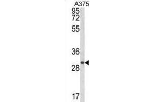 Western Blotting (WB) image for anti-Collagen Triple Helix Repeat Containing 1 (CTHRC1) antibody (ABIN3003906) (CTHRC1 Antikörper)