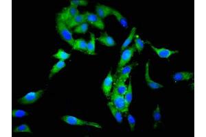 Immunofluorescent analysis of Hela cells using ABIN7168715 at dilution of 1:100 and Alexa Fluor 488-congugated AffiniPure Goat Anti-Rabbit IgG(H+L) (SCG3 Antikörper  (AA 205-432))