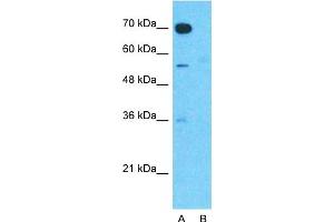 Host:  Rabbit  Target Name:  TMEM16A  Sample Type:  Human Fetal Muscle  Lane A:  Primary Antibody  Lane B:  Primary Antibody + Blocking Peptide  Primary Antibody Concentration:  1ug/ml  Peptide Concentration:  5ug/ml  Lysate Quantity:  25ug/lane/lane  Gel Concentration:  0. (ANO1 Antikörper  (Middle Region))