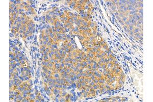 ABIN6258520 and ABIN6274742 at 1/100 staining Rat ovarian tissue by IHC-P. (MRPL44 Antikörper)