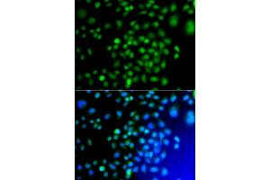 Immunofluorescence analysis of A549 cells using ATF7 antibody (ABIN5975307). (AFT7 Antikörper)
