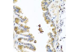 Immunohistochemistry of paraffin-embedded mouse lung using CHI3L2 antibody (ABIN5975154) at dilution of 1/100 (40x lens). (CHI3L2 Antikörper)