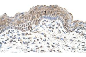 TAPBP antibody was used for immunohistochemistry at a concentration of 4-8 ug/ml to stain Squamous epithelial cells (arrows) in Human Skin. (TAPBP Antikörper)