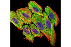 Immunocytochemistry (ICC) image for anti-Chemokine (C-C Motif) Ligand 2 (CCL2) antibody (ABIN1846382)