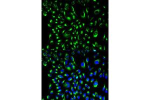Immunofluorescence analysis of HeLa cell using LCP2 antibody.