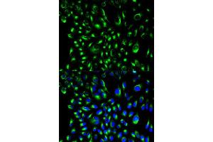 Immunofluorescence analysis of HeLa cell using LCP2 antibody. (LCP2 Antikörper  (AA 284-533))