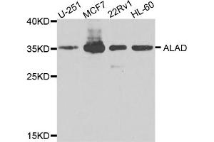Western blot analysis of extracts of various cell lines, using ALAD antibody (ABIN5974581) at 1/1000 dilution. (ALAD Antikörper)
