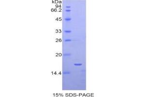 SDS-PAGE analysis of Human SIGLEC1 Protein. (Sialoadhesin/CD169 Protein)