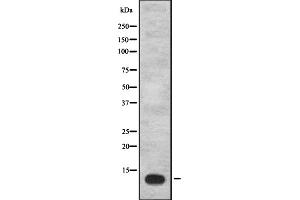 Western blot analysis of IGFL1 expression in Hela cell lysate,The lane on the left is treated with the antigen-specific peptide.