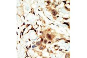 Image no. 2 for anti-Insulin Receptor (INSR) (N-Term) antibody (ABIN359886) (Insulin Receptor Antikörper  (N-Term))