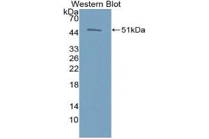 Western blot analysis of the recombinant protein. (EPO Antikörper  (AA 28-193))