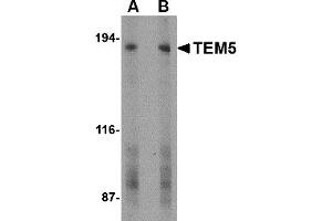 Western Blotting (WB) image for anti-G Protein-Coupled Receptor 124 (GPR124) (C-Term) antibody (ABIN1030729)