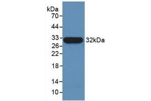 Detection of Recombinant TUBb, Human using Monoclonal Antibody to Tubulin Beta (TUBb) (TUBB Antikörper  (AA 170-419))