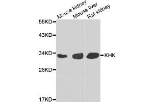 Western blot analysis of extracts of various cell lines, using KHK antibody. (Ketohexokinase Antikörper)