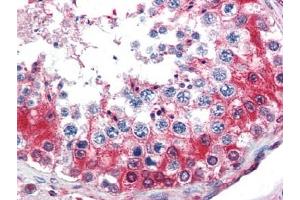 Image no. 1 for anti-Glyceraldehyde-3-Phosphate Dehydrogenase (GAPDH) (AA 73-87) antibody (ABIN372846)