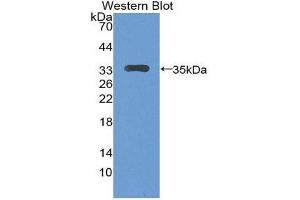Western Blotting (WB) image for anti-Latent Transforming Growth Factor beta Binding Protein 2 (LTBP2) (AA 522-814) antibody (ABIN1869055) (LTBP2 Antikörper  (AA 522-814))