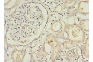 Immunohistochemistry of paraffin-embedded human kidney tissue using ABIN7171269 at dilution of 1:100 (STXBP6 Antikörper  (AA 2-210))