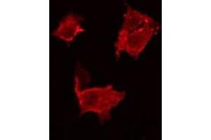 ABIN6266858 staining HeLa by IF/ICC. (BCAR3 Antikörper  (C-Term))