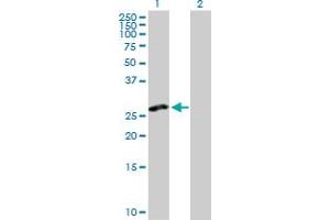 Western Blotting (WB) image for anti-C-Type Lectin Domain Family 2, Member D (CLEC2D) (AA 1-191) antibody (ABIN526096)