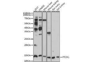Western blot analysis of extracts of various cell lines, using PROK1 antibody (ABIN7269546) at 1:1000 dilution. (Prokineticin 1 Antikörper)