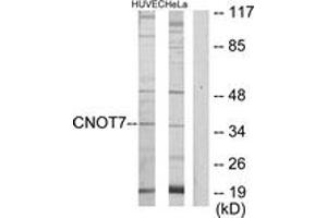 Western blot analysis of extracts from HeLa/HuvEc cells, using CNOT7 Antibody. (CNOT7 Antikörper  (AA 10-59))