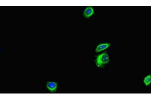 Immunofluorescent analysis of HepG2 cells using ABIN7144171 at dilution of 1:100 and Alexa Fluor 488-congugated AffiniPure Goat Anti-Rabbit IgG(H+L) (ANKS6 Antikörper  (AA 1-132))