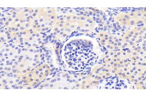 Immunohistochemistry (IHC) image for anti-Mannose Phosphate Isomerase (MPI) (AA 2-423) antibody (ABIN7441487)