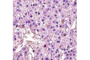 Immunohistochemistry (IHC) image for anti-Lactate Dehydrogenase A (LDHA) (AA 204-232) antibody (ABIN3031580)