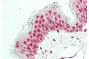 Immunohistochemistry (IHC) image for anti-POU Class 2 Homeobox 3 (POU2F3) (N-Term) antibody (ABIN2779706)