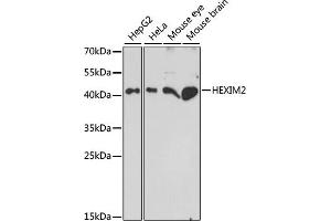 Western blot analysis of extracts of various cell lines, using HEXIM2 antibody (ABIN7267637) at 1:1000 dilution. (HEXIM2 Antikörper  (AA 147-286))
