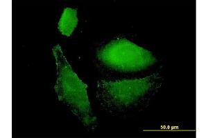 Immunofluorescence of monoclonal antibody to VAMP1 on HepG2 cell. (VAMP1 Antikörper  (AA 28-96))