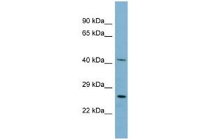 WB Suggested Anti-MRPS2 Antibody Titration: 0. (MRPS2 Antikörper  (N-Term))