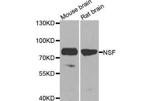 Western blot analysis of extracts of various cell lines, using NSF antibody. (NSF Antikörper)