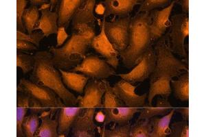 Immunofluorescence analysis of U-2OS cells using Caspase-3 Polyclonal Antibody at dilution of 1:100. (Caspase 3 Antikörper)