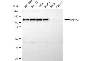 Western blotting analysis using SRPK2 antibody (ABIN7800327). (SRPK2 Antikörper)