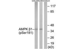 Western blot analysis of extracts from COLO205 cells and HuvEc cells, using AMPK beta1 (Phospho-Ser181) Antibody. (PRKAB1 Antikörper  (pSer182))