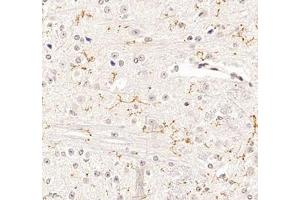 Immunohistochemistry of paraffin embedded mouse spinal cord using P2Y12 (ABIN7075321) at dilution of 1: 1400 (400x lens) (P2RY12 Antikörper)