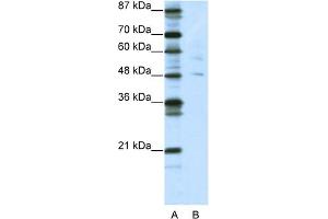 WB Suggested Anti-PLAGL1 Antibody Titration:  5. (PLAGL1 Antikörper  (N-Term))